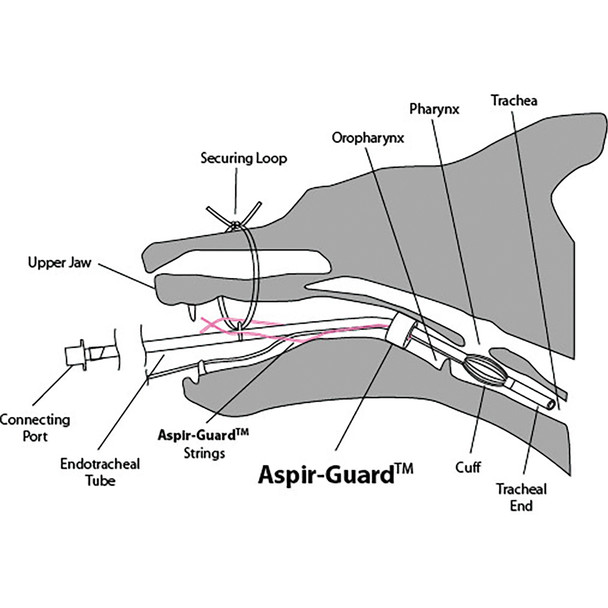 Aspir-Guard